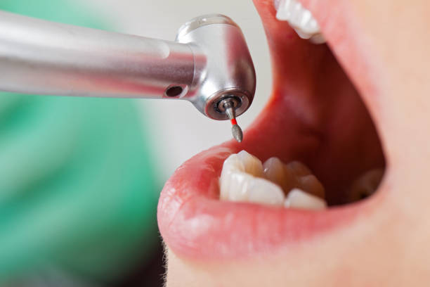 Best Chipped Tooth Repair Near Me  in Loretto, TN